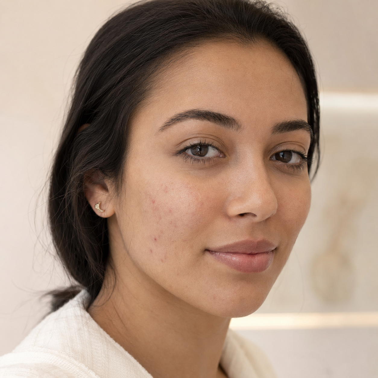 Tratamento para acne